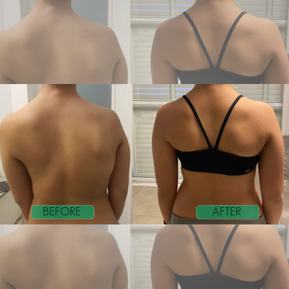 Instant Posture Corrector